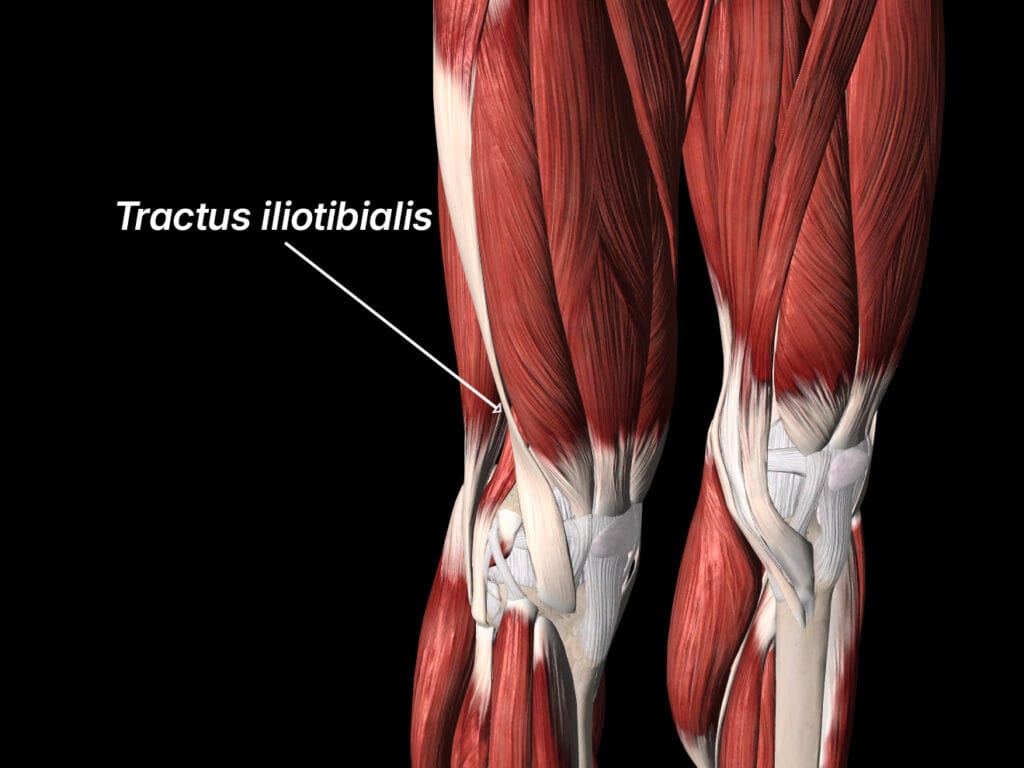 Runners knee